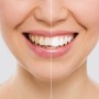 Zahnweißstift Witen InnovaGoods 2 Stück (Restauriert A)